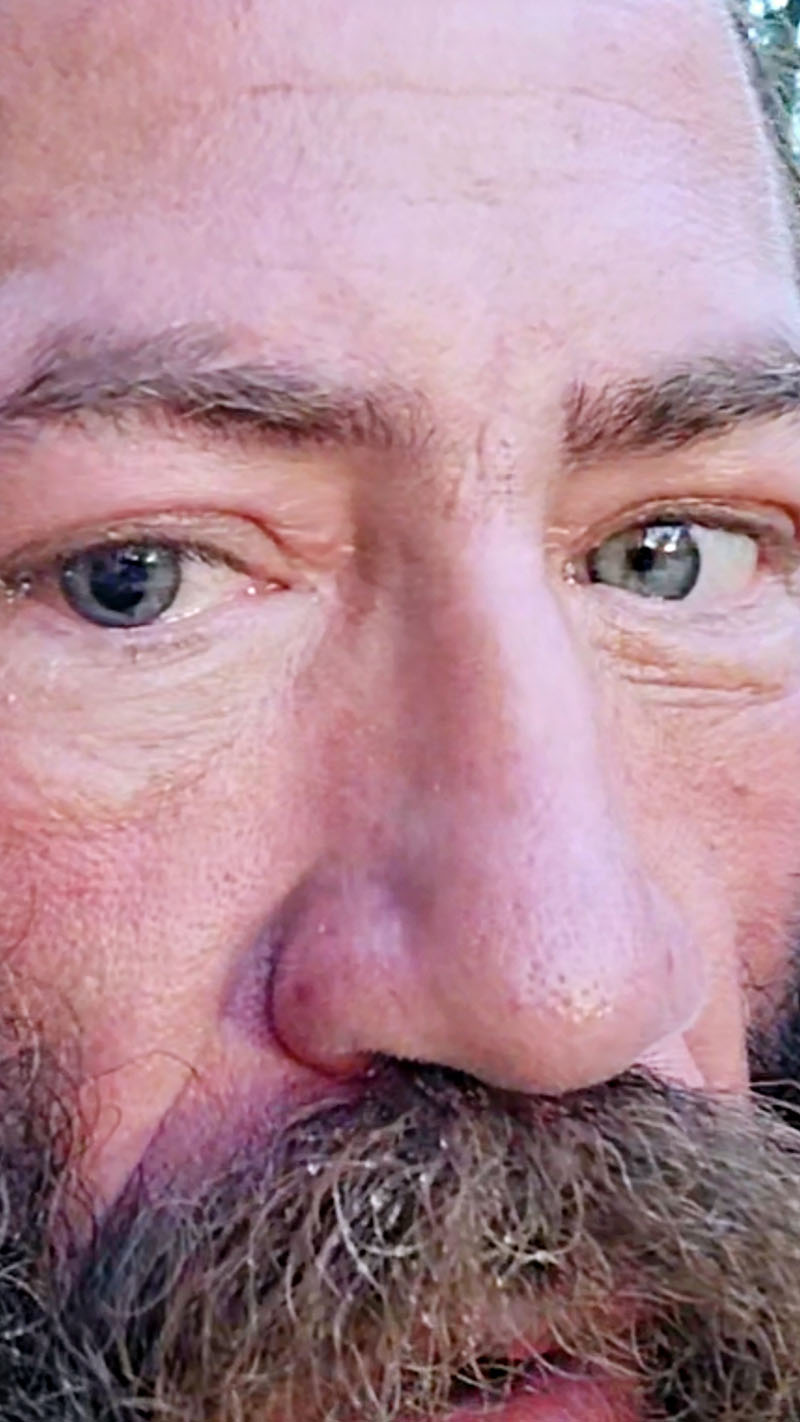 Liver king s eye healing protocol